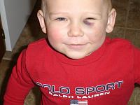 First &quot; shiner &quot; !-pics-1-009.jpg